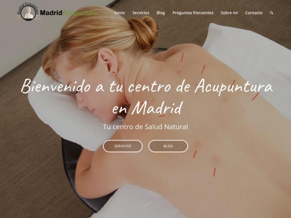 madridacupuntura.com